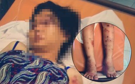Vụ cô gái mang thai 6 tháng bị "bắt cóc", đánh đập khiến thai nhi tử vong ở Sài Gòn: Kinh hoàng màn tra tấn như thời Trung cổ