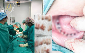 Nha sĩ đăng ảnh nhổ 18 răng sâu của cháu bé không chịu đánh răng kèm theo chia sẻ được nhiều bố mẹ đồng cảm