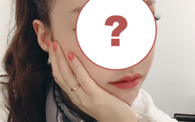 Hiếm lắm mới có nữ idol đình đám Kpop công khai việc "dao kéo", lại còn khoe kết quả lên Instagram