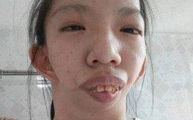 Cô gái sở hữu gương mặt "Thị Nở", nuôi ước mơ trở thành phiên dịch tiếng Trung