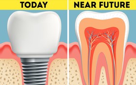 Không phải trồng răng giả nữa: Khoa học đã tìm ra cách giúp bạn mọc lại răng mới chỉ sau 2 tháng