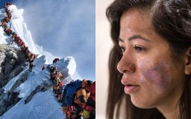 "Tắc đường" ở Everest: Ký ức kinh hoàng đầy ám ảnh của cô gái trở về từ cõi chết và những mặt tối đáng sợ bị bóc trần