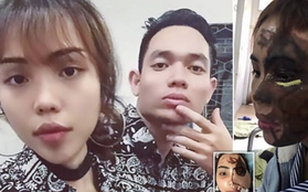 Dân mạng nước ngoài bày tỏ sự thương cảm với cô gái Việt Nam bị chồng sắp cưới tạt axit đến biến dạng khuôn mặt