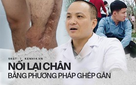 Hành trình 5 năm, 7 lần phẫu thuật cứu chân dập nát cho cậu sinh viên 19 tuổi của các y bác sĩ bệnh viện Việt Đức