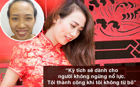 Chê bai người khác không làm bạn tốt hơn: Hãy ngưng kì thị ngoại hình của những người kém may mắn