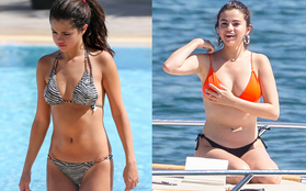 Xót xa body "một trời một vực" của Selena Gomez trước và sau phẫu thuật ghép thận