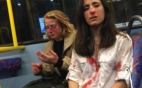 Hai cô gái đồng tính bị hành hung dã man chỉ vì không chịu hôn nhau cho những thanh niên trên xe buýt xem