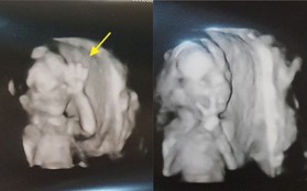 Chụp ảnh siêu âm mà giơ tay chào đủ kiểu, em bé từ trong bụng mẹ đã được dự đoán tương lai sau này vô cùng xán lạn