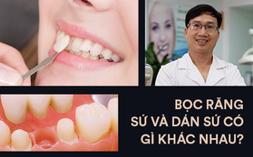 Nha sĩ chỉ ra sự khác biệt giữa hai phương pháp thẩm mỹ răng hot nhất hiện nay: bọc răng sứ và dán sứ veneer