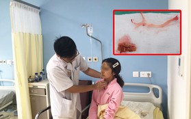 Cô gái Hải Phòng suýt nứt thực quản vì hóc thịt bò trong cổ họng suốt 3 ngày