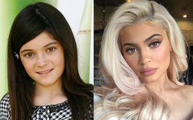 Kylie Jenner tiêm thẩm mỹ môi nhìn cực quyến rũ nhưng Hiệp hội bác sĩ thẩm mỹ Úc lại cảnh báo có nguy cơ gây mù lòa