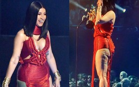 Không dám nhìn hình ảnh Cardi B quyết hở bạo, lồ lộ đôi chân biến dạng nặng nề hậu "dao kéo" tại VMAs