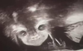 Đi siêu âm thai nhi 24 tuần tuổi, bà mẹ hết hồn khi thấy hình ảnh bé con như đang nhìn chằm chằm mình
