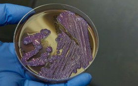 Mọi thông tin về căn bệnh "nhiễm khuẩn ăn thịt người" - Whitmore, đặc biệt là cách phòng ngừa cần lưu ý