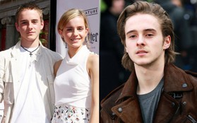 Màn dậy thì ngoạn mục của em trai Emma Watson bỗng hot trở lại: Nam thần ngày càng đẹp không lối thoát!