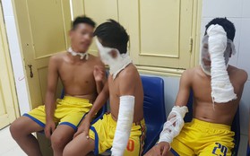 Chùm bóng bay phát nổ, 3 cầu thủ U14 Sông Lam Nghệ An nhập viện