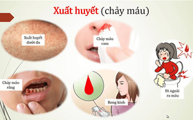 Bác sĩ chỉ rõ 2 biến chứng nguy hiểm của sốt xuất huyết, dấu hiệu cảnh báo cần đến viện ngay