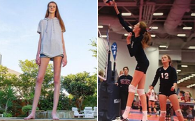Cô gái mới 16 tuổi đã sở hữu chiều cao khủng, đôi chân dài kỷ lục 1,34m khiến ai cũng phải trầm trồ "chân dài tới nách" là có thật
