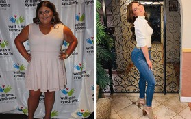 Từng khổ sở vì nặng tới 108kg, nàng béo người Mỹ lột xác ngoạn mục sau khi giảm 54kg chỉ sau 10 tháng