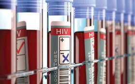 Xuất hiện bệnh nhân thứ 3 trên thế giới được chữa khỏi HIV