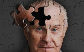 Công bố mới: Đã có vắc-xin đặc trị chứng mất trí Alzheimer