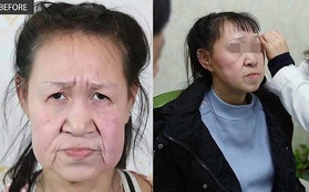 Cô gái 15 tuổi nhưng sở hữu gương mặt như cụ bà nay đã có diện mạo mới khiến ai cũng trầm trồ