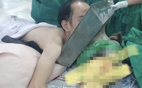 Tai nạn kinh hoàng: Chàng trai 27 tuổi bị máy xay thịt cuốn cả cánh tay đến sát vai, mặt bị kéo vào mâm inox, tình trạng nguy kịch