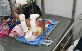 Người cha bạo hành con 4 tháng tuổi xuất huyết não, gãy xương ở Sài Gòn thừa nhận do mâu thuẫn với vợ