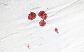 Chảy máu sau khi quan hệ có thể là dấu hiệu cho thấy bạn đang gặp phải vấn đề gì?
