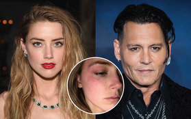 Amber Heard và Johnny Depp: Thành đôi từ "phim giả tình thật", giờ sự nghiệp diễn xuất bị ồn ào bạo hành, ly hôn huỷ hoại