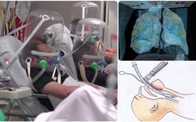 Bệnh nhân nhiễm Covid-19 phải nghiêm trọng thế nào mới phải sử dụng đến máy trợ thở?