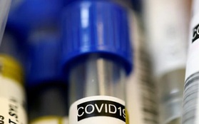 Tốc độ lây nhiễm dịch Covid-19 ở Belarus trong top cao nhất ở Châu Âu