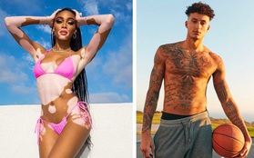 Bí quyết nào giúp siêu mẫu bạch biến Winnie Harlow vượt mặt hàng loạt sao nữ trong showbiz và chinh phục trái tim chàng badboy có tiếng như Kyle Kuzma?