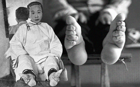 Tục bó chân của phụ nữ Trung Hoa cổ đại: Nỗi đau từ thể xác đến tinh thần không từ ngữ nào có thể diễn đạt trọn vẹn