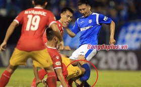 Sốc: Cầu thủ Than Quảng Ninh gãy chân sau pha va chạm kinh hoàng