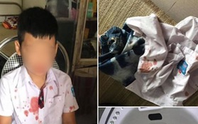 Vụ người đàn ông đấm hộc máu mồm bé trai lớp 1 để "trả thù" thay con: Mẹ nạn nhân lên tiếng
