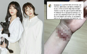 Mina đăng ảnh sẹo chi chít ở cổ tay sau những lần tự tử bất thành, "dập" luôn lời phản bác của Jimin (AOA)