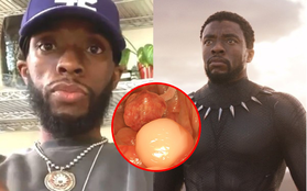 "Black Panther" Chadwick Boseman qua đời vì ung thư đại tràng: 7 dấu hiệu cảnh báo cho biết bạn cũng có thể mắc phải căn bệnh quái ác này