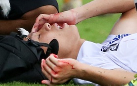 Cầu thủ trẻ HAGL chảy máu đầu đầm đìa sau va chạm vẫn cố thi đấu hết trận
