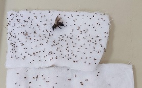 Hi Hữu: Người đàn ông 40 tuổi bị 100 con ong đốt khắp cơ thể