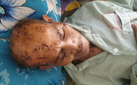 Vụ cụ ông 74 tuổi bị rạch nát đầu: Khởi tố, bắt tạm giam cháu nội nạn nhân