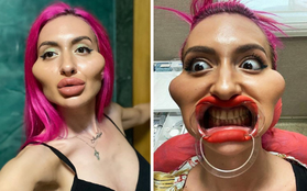 Cô gái với "cặp má lớn nhất thế giới" từng gây tranh cãi trên MXH khiến dân tình tiếc hùi hụi khi lộ ảnh chân dung trước đây