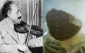 Chuyện ly kỳ về bộ não bị đánh cắp của Albert Einstein: Trở thành vật nghiên cứu bất chấp di ngôn, chứa nhiều đặc điểm khác biệt của thiên tài