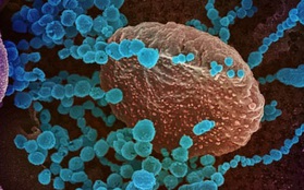Phát hiện kháng thể bảo vệ con người thoát khỏi SARS-CoV-2 và các biến thể