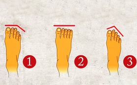 Cho 3 giây soi kỹ bàn chân: Hình dạng ngón chân sẽ tiết lộ những đặc điểm trong tính cách, cuộc sống của bạn sau này