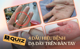 Quiz: 4 biểu hiện trên bàn tay cho thấy dạ dày và ruột của bạn đang bị tổn thương, nếu không có cái nào thì xin chúc mừng