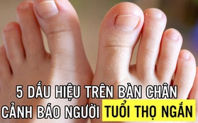 5 dấu hiệu tuổi thọ ngắn nhìn thấy rõ rệt ngay trên bàn chân: Nếu ai có đủ thì cần thay đổi lối sống ngay từ bây giờ