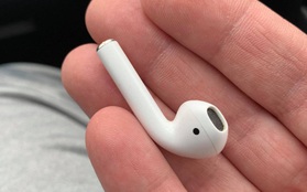 Đeo tai nghe lúc ngủ, anh thanh niên vô tình nuốt luôn 1 bên AirPods khiến nó kẹt cứng ở thực quản