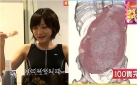 Ăn 100 miếng sushi cùng lúc, nữ YouTuber gây sốc khi công khai luôn ảnh chụp CT dạ dày, chứng minh mình không gian dối