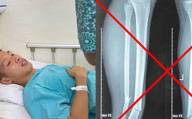 Thực hư ảnh chụp X-quang gãy rời 2 chân gây sốc của Hùng Dũng